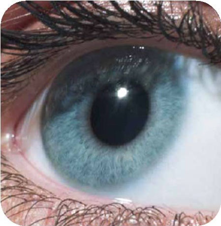 แก้ปัญหาสายตาด้วยเลนส์เสริม ICL